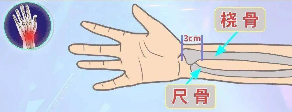 男子昏迷数日无人知竟是被卡在家中 居家意外伤害这样防范