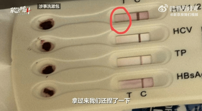 顾客称在酒店洗漱包内发现用过的HIV检测盒，当晚紧急就医，各方最新回应