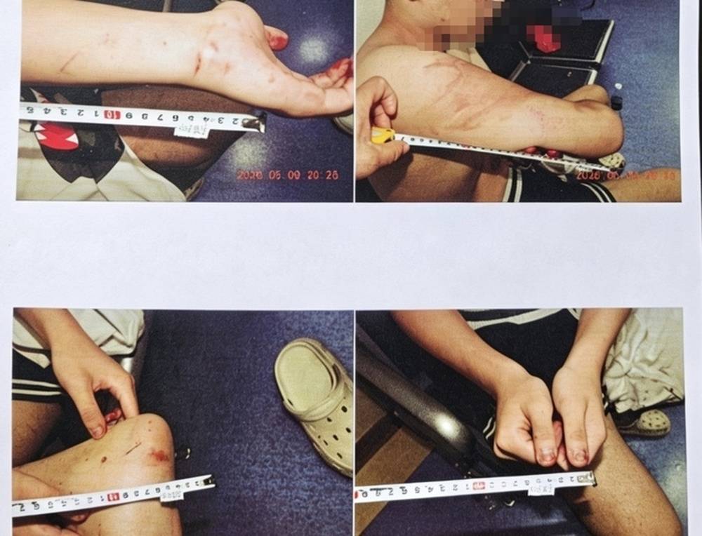 17岁男生家门口遭两次殴打案最新进展:伤情鉴定为轻伤二级,警方以涉嫌寻衅滋事罪进行侦办